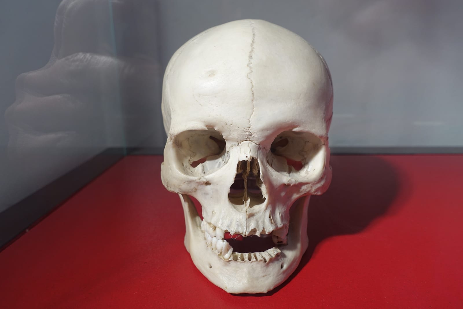 Skull